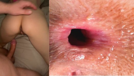 Stepdaughter farted in my nose. Hm I didn’t think she wants my inheritance